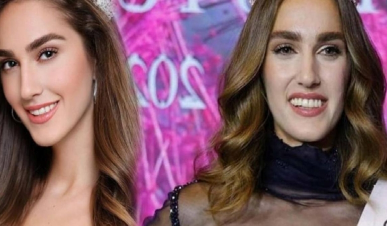 Birinciliği tartışılan Türkiye güzeli bu sefer de yaş hesabıyla gündemde