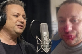 Ünlü sanatçı et yiyen bakteriyle savaşıyor