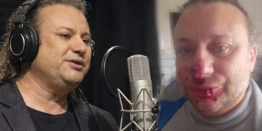 Ünlü sanatçı et yiyen bakteriyle savaşıyor